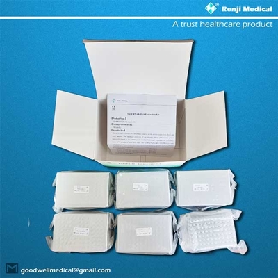 Renji Rna Bộ tách axit nucleic virut 48 Thử nghiệm Phương pháp hạt từ tính